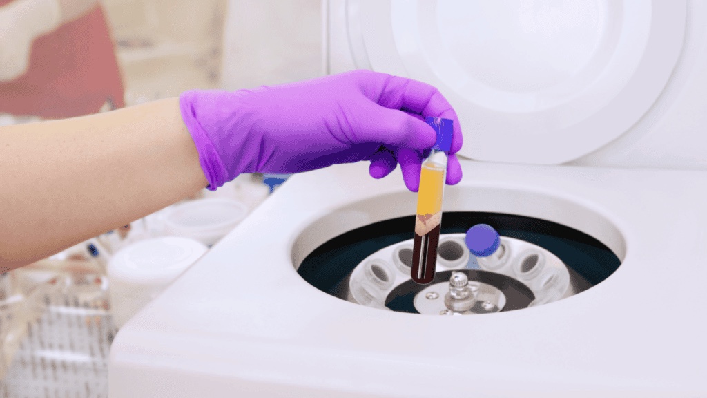 Platelet-rich plasma separated in a centrifuge tube